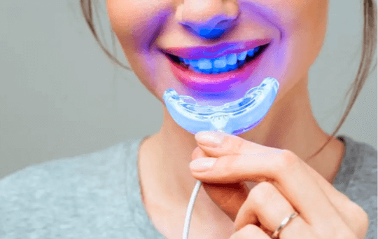 Unlocking the Secrets of a Perfect Smile with LED Teeth Whitening Kits